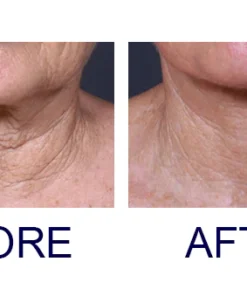 ODEIUN® CollagenFirming Lifting Neck Cream