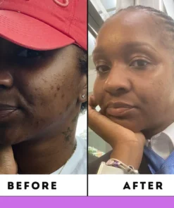 ODEIUN™ Divine Healing Clay Mask