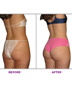 ORGADECO™ Hip Plump Capric Oil