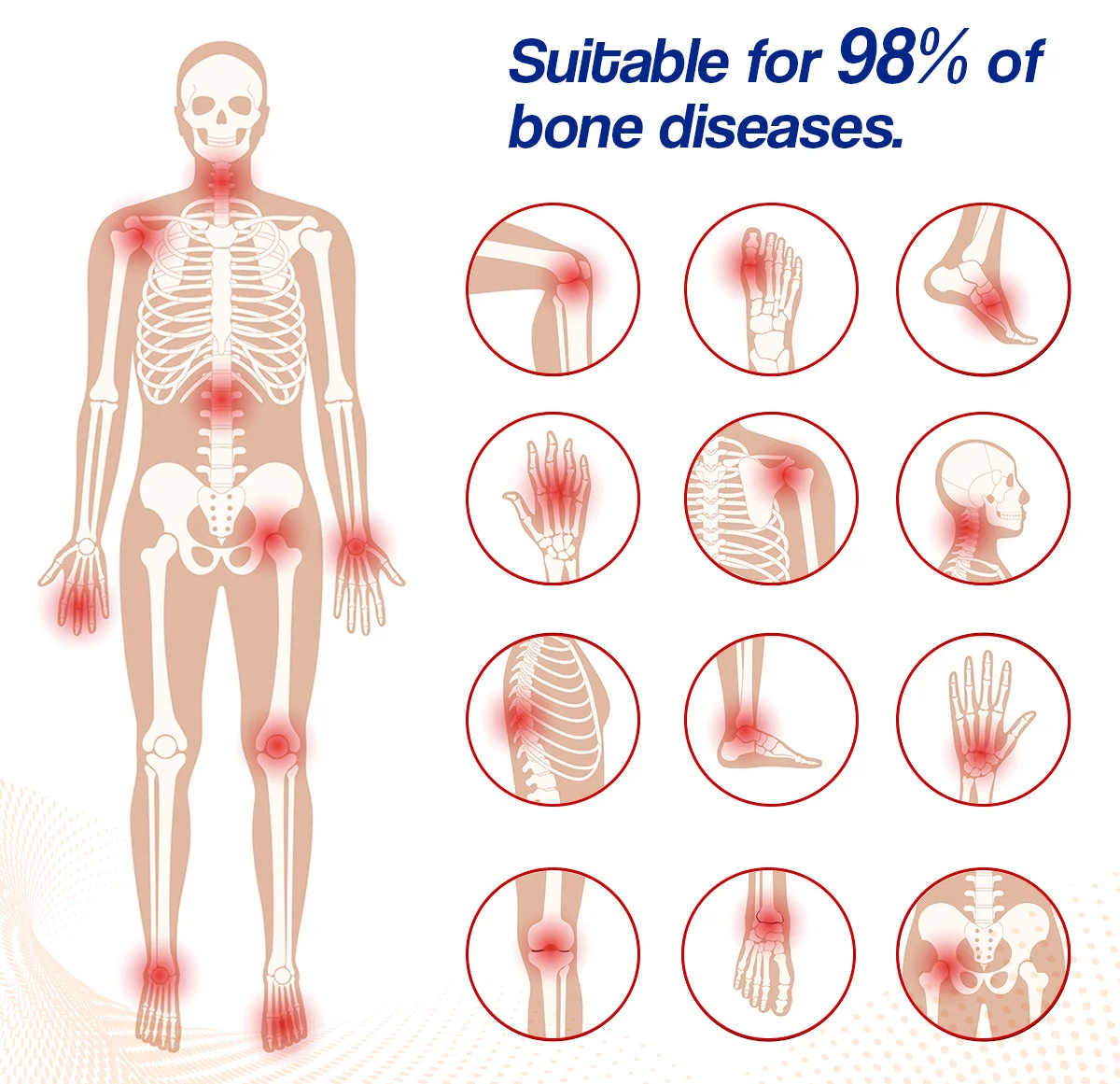 Ourlyard™ Bee Venom Joint Therapy Cream: Relieve stiffness and swelling