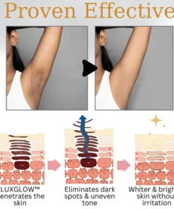 Oveallgo™ Body Whitening Cream