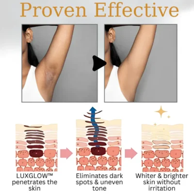 Oveallgo™ Body Whitening Cream