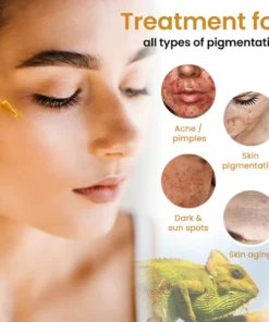 Oveallgo™ Dark Spot and Skin Tone Corrector