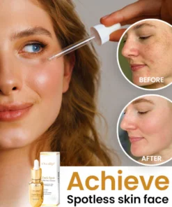 Oveallgo™ Dark Spot and Skin Tone Corrector