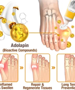 Oveallgo™ HalluxCare Bee Venom Treatment Cream