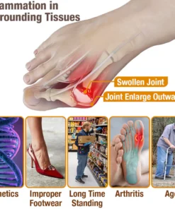 Oveallgo™ HalluxCare Bee Venom Treatment Cream