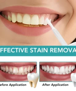 Oveallgo™ Instant Teeth Whitening Paint