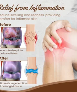 Oveallgo™ JointCure Organic Herbal Salve