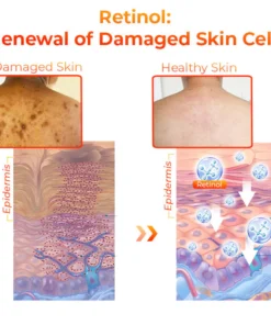 Oveallgo™ Kojic Acid Dark Spot Corrector Soap