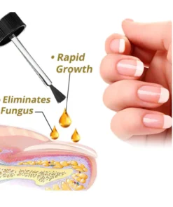 Oveallgo™ NailGro Intense Nail Growth and Strengthening Serum