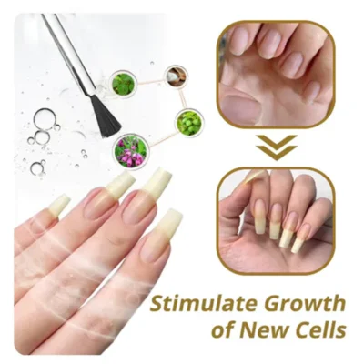 Oveallgo™ NailGro Intense Nail Growth and Strengthening Serum