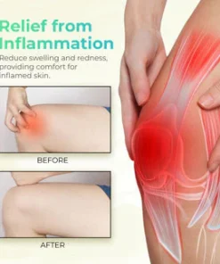 Oveallgo™ ORGANIC HERBAL SALVE (4OZ)