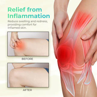 Oveallgo™ ORGANIC HERBAL SALVE (4OZ)