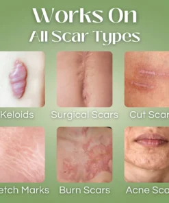 Oveallgo™ Scar Repair Essence