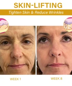 Oveallgo™ SkinFirming Rejuvenating Oil