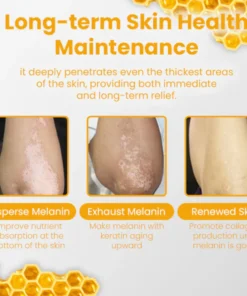 Oveallgo™ Vitiligo Rescue Bee Venom Care Cream