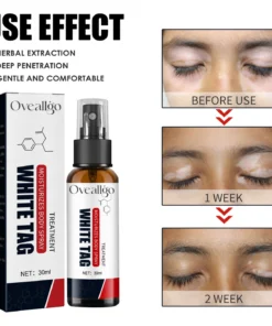 Oveallgo™ White Spot Clear Spray