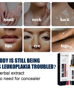 Oveallgo™ White Spot Clear Spray