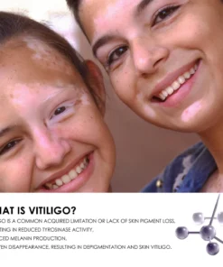 Oveallgo™ White Spot Clear Spray