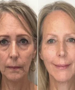 PEPTIDE Wrinkle Reducing Cream