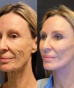 PEPTIDE Wrinkle Reducing Cream