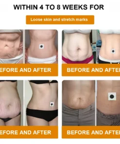 REFRLIFE™ Propolis Detox Slimming Patch