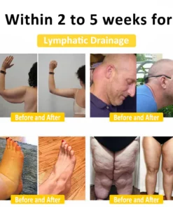 SEAGRIL™ Bee Venom Lymphatic Drainage Slimming Soap