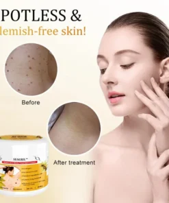 SEAGRIL™ Bee Venom Mole and Wart Treatment Cream