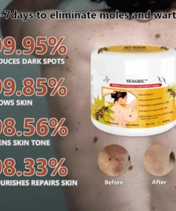 SEAGRIL™ Bee Venom Mole and Wart Treatment Cream