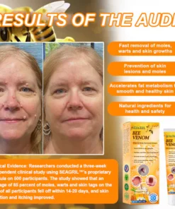 SEAGRIL™ Bee Venom Wart & Tag Removal Cream