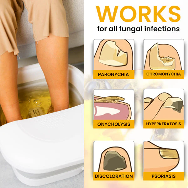 SENUIZ™ Bee Venom Nail Fungus Treatment Soak