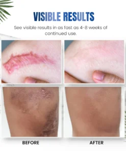 Seurico™ Advanced Silicone Skin Renewal Gel