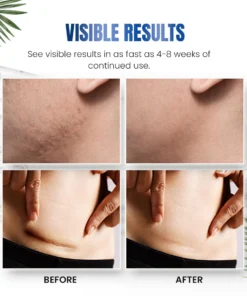 Seurico™ Advanced Silicone Skin Renewal Gel