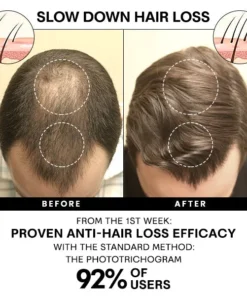 Seurico™ Anti-Shedding Hair Spray