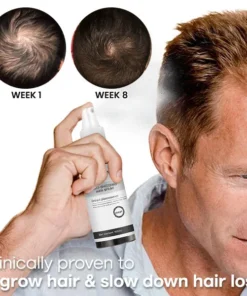 Seurico™ Anti-Shedding Hair Spray