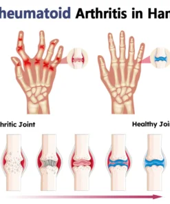 Seurico™ Bee Venom Joint and Bone Therapy Advanced Cream
