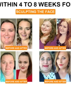 Seurico™ Bee Venom Lymphatic Drainage Slimming Patch