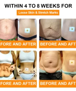 Seurico™ Bee Venom Lymphatic Drainage Slimming Patch