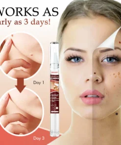 Seurico™ Bee Venom Mole Wart Removal Pen