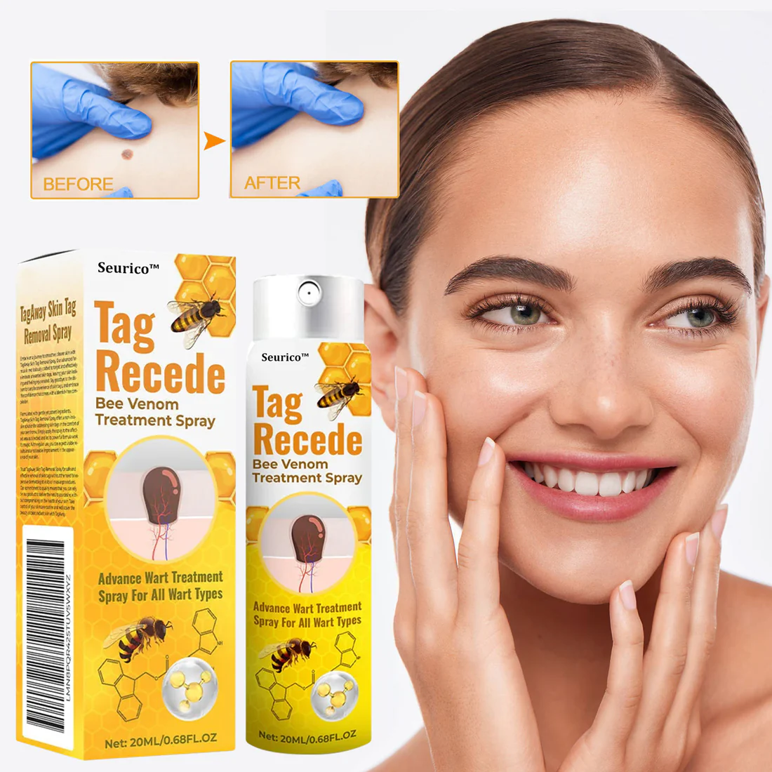 Seurico™ Bee Venom Power Mole & Wart Remover Spray