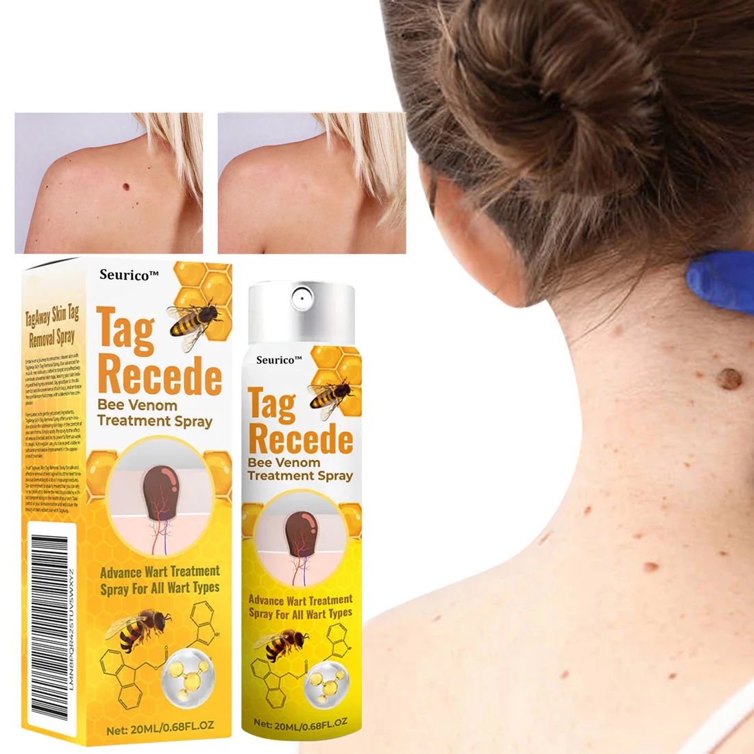 Seurico™ Bee Venom Power Mole & Wart Remover Spray