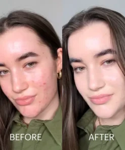 Seurico™ Dermatitis Repair Cream