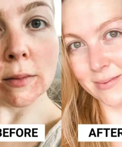 Seurico™ Dermatitis Repair Cream