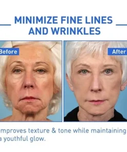 Seurico™ HYALU B5 SERUM