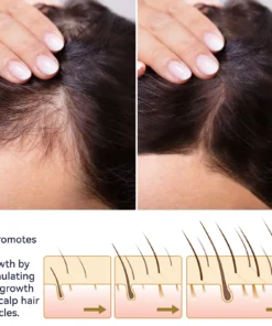 Seurico™ Hair Growth Spary