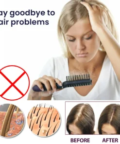 Seurico™ Hair Growth Spary