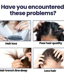 Seurico™ Hair Growth Spary