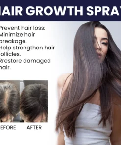 Seurico™ Hair Growth Spary