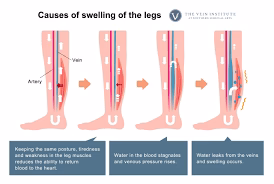 Seurico™ Lymphatic Healing Ginger Patch - Image 11