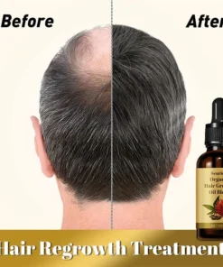 Seurico™ Organic hair growth oil blend